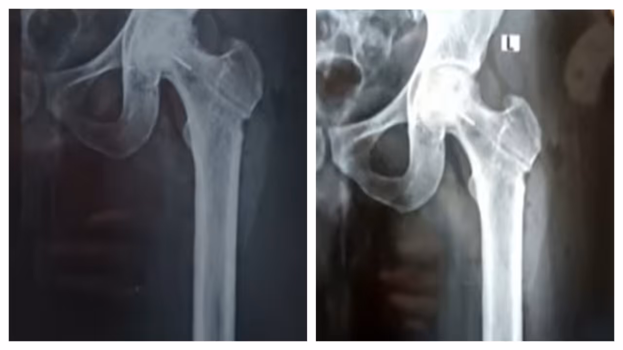 Image of latest news